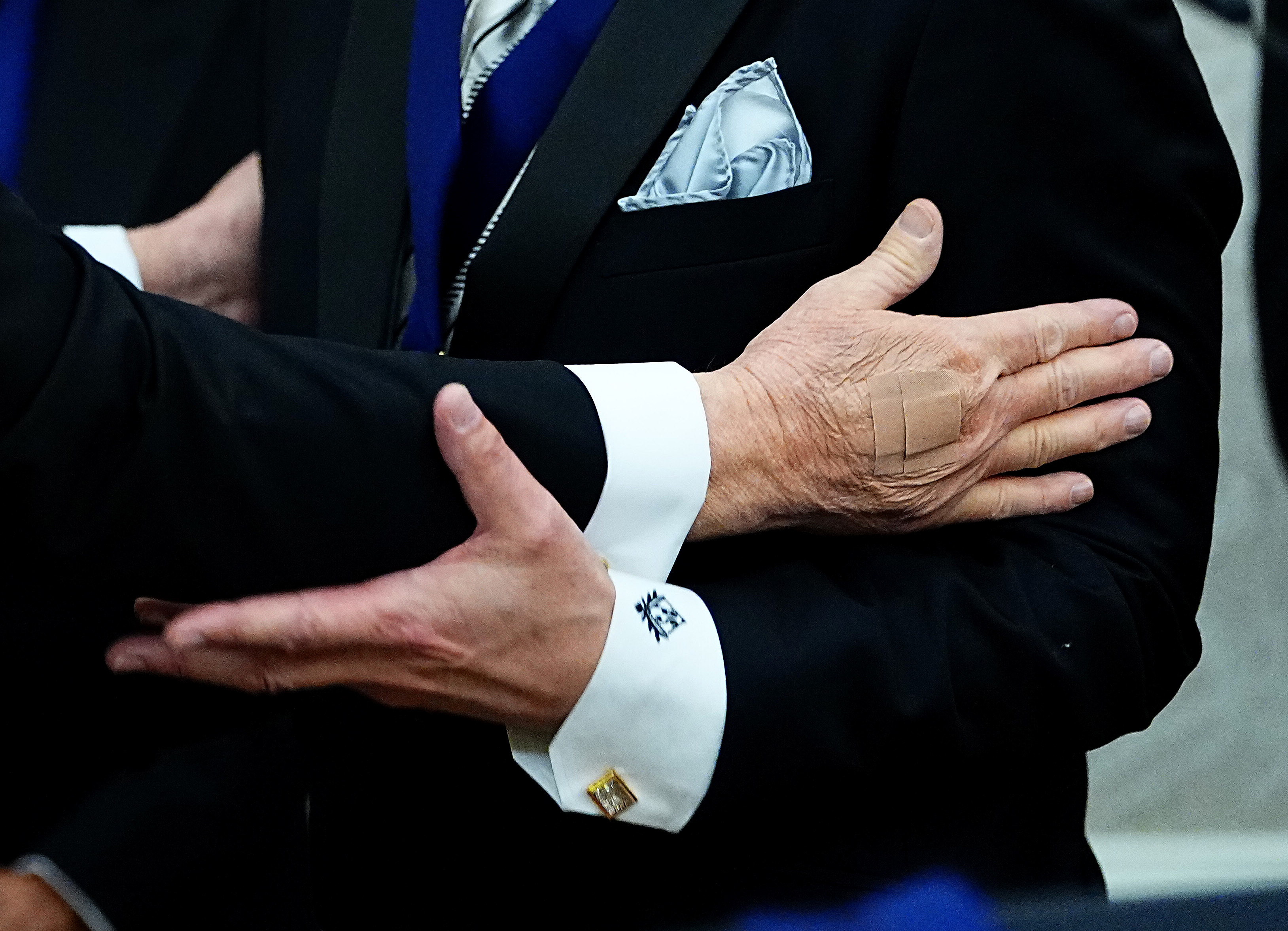 Bandages are visible on the hand of U.S. President Donald Trump during the medal presentation ceremony for the 2025 Kennedy Center Honorees in the Oval Office of the White House on December 06, 2025...