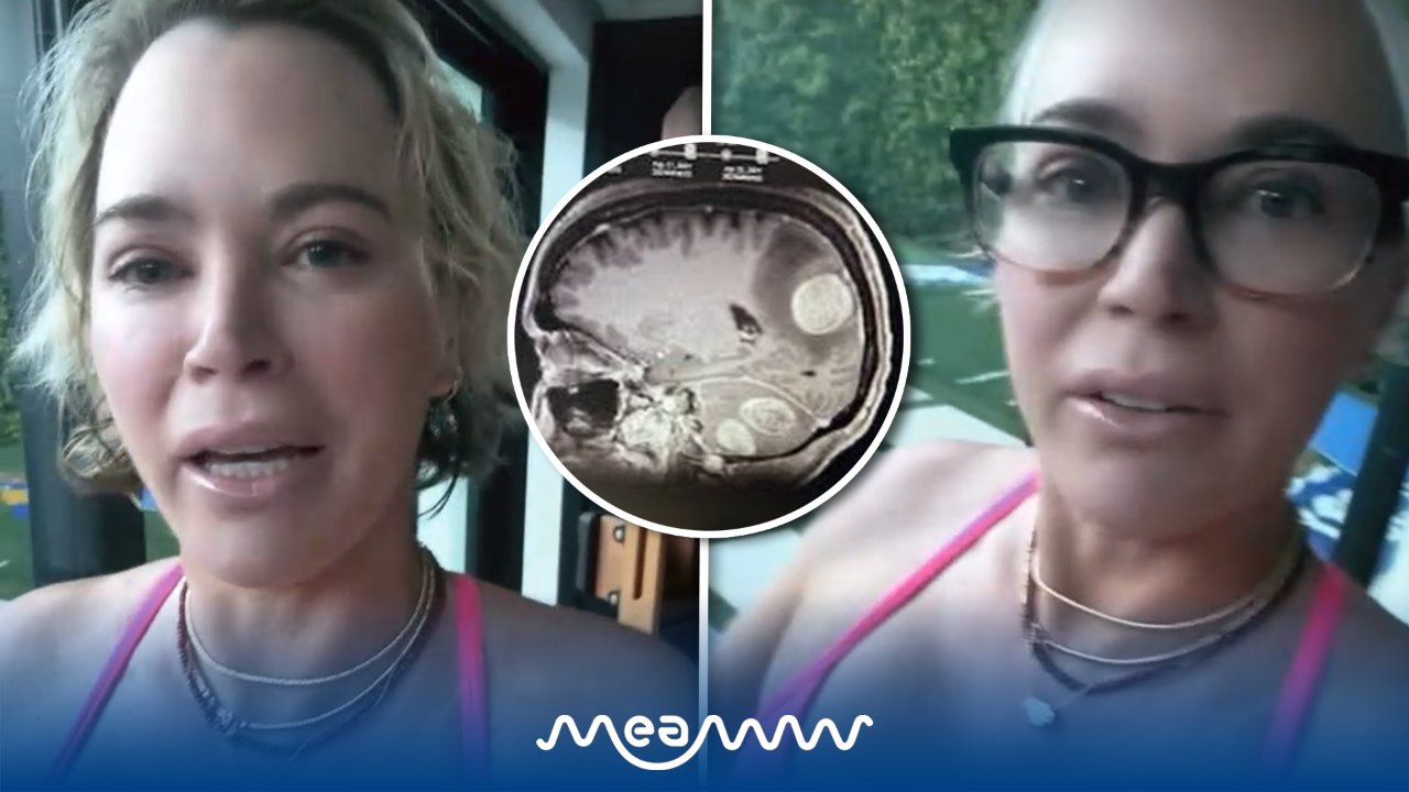 Teddi Mellencamp BREAKS DOWN CRYING as She Struggles to See and Write After Brain Surgery