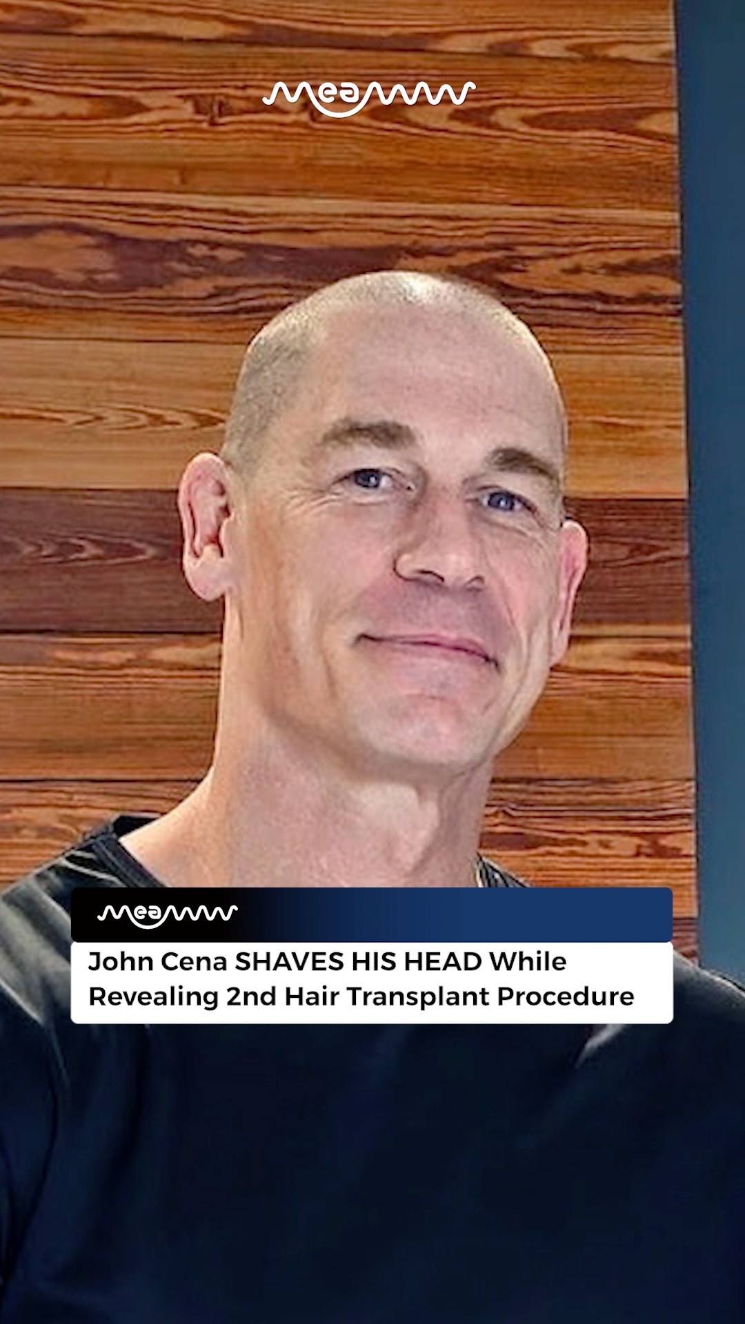 John Cena SHAVES HIS HEAD While Revealing 2nd Hair Transplant Procedure