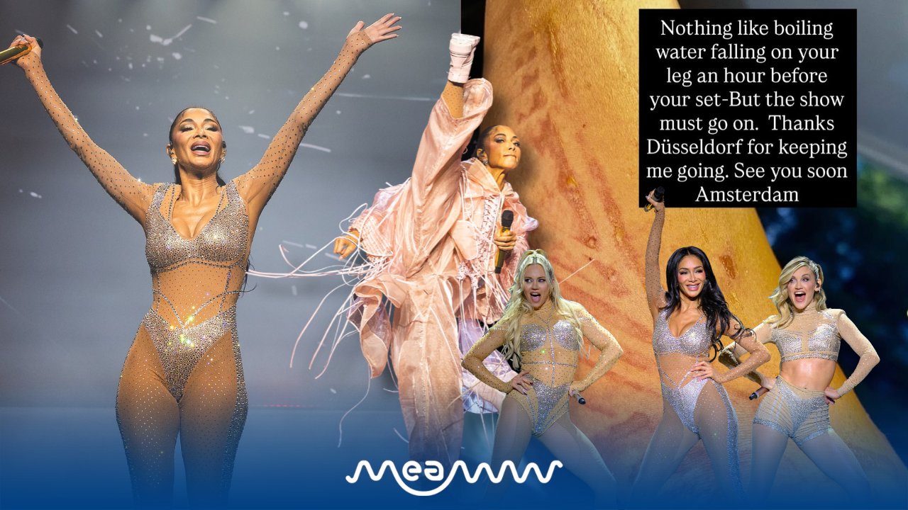 Nicole Scherzinger Performed One Hour After Boiling-Water Burn Leaves Her Leg Blistered