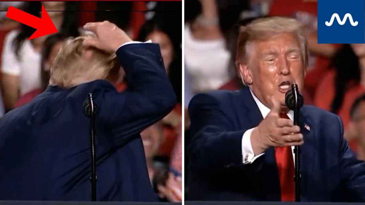 ‘Now I’m Depressed’: Trump Jokes About Losing His Hair